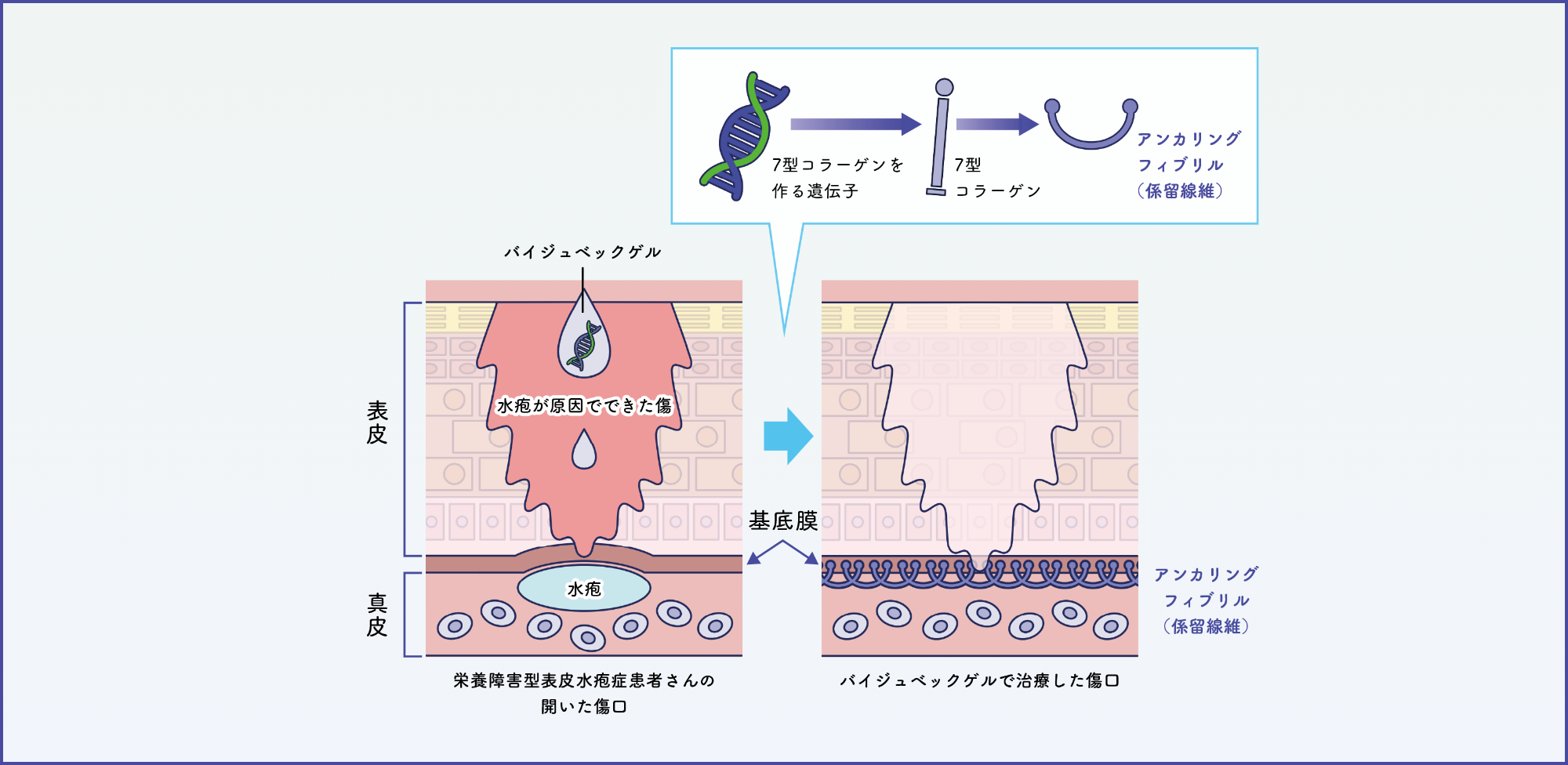 バイジュベックゲルの投与によって傷口が治癒するイメージ図